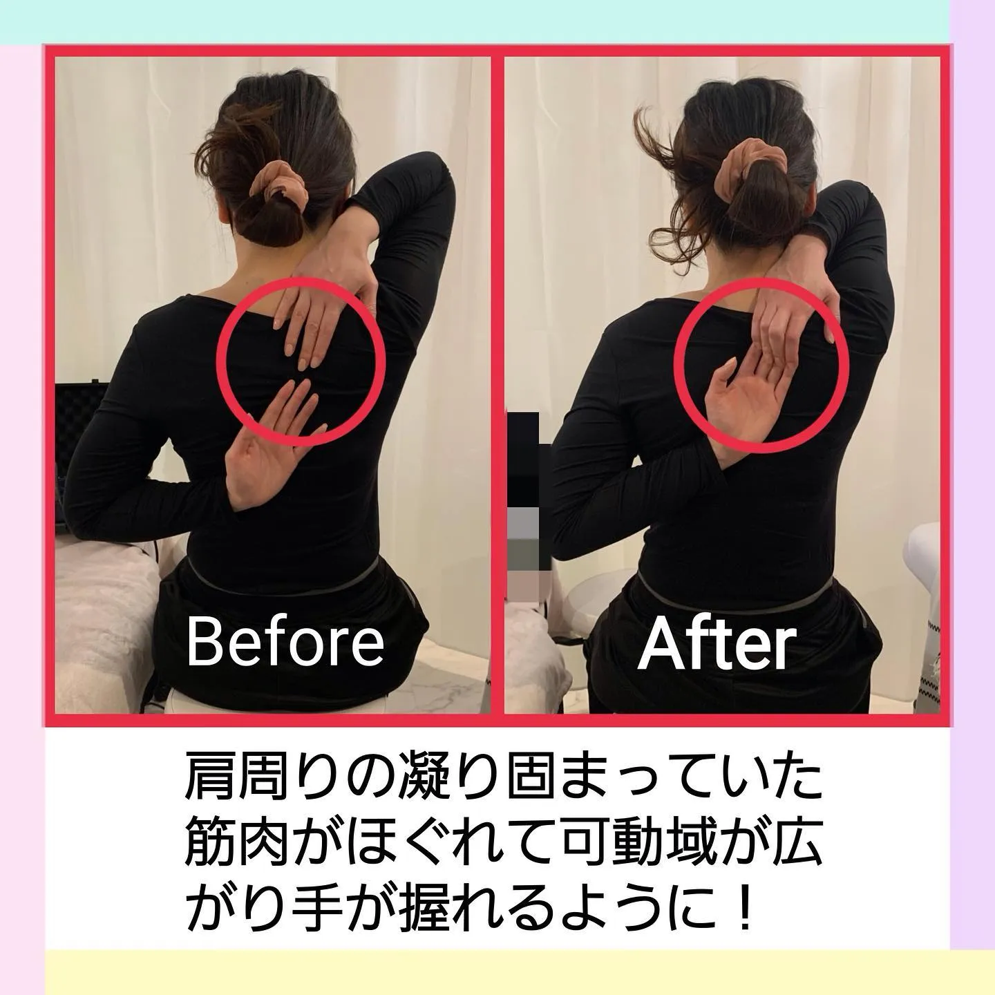 エクソソーム1回のBefore After です🌟