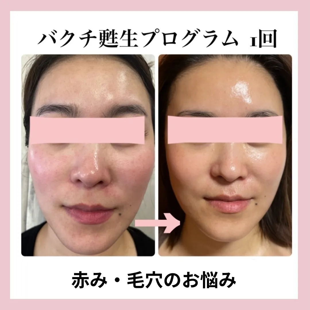 バクチ甦生プログラム