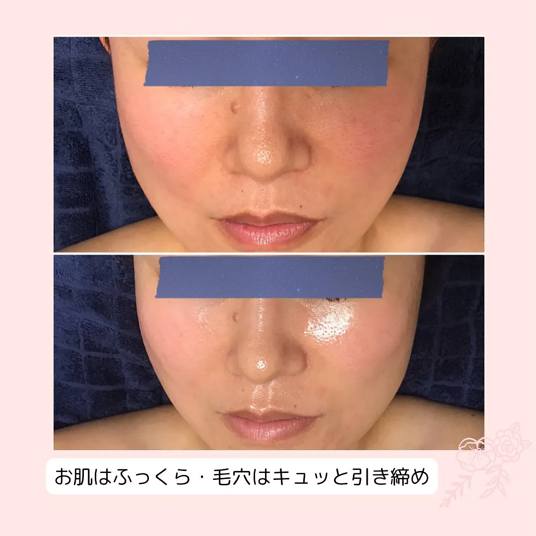 元々お顔の小さい方ですが