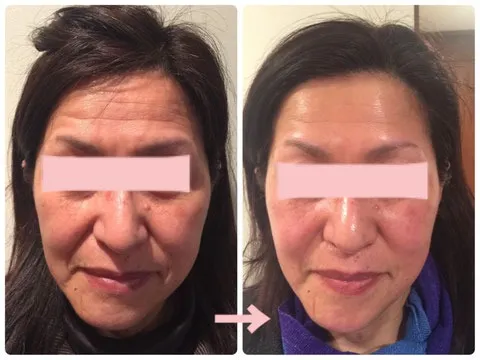 バクチ甦生プログラム