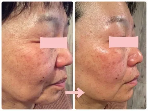 バクチ甦生プログラム